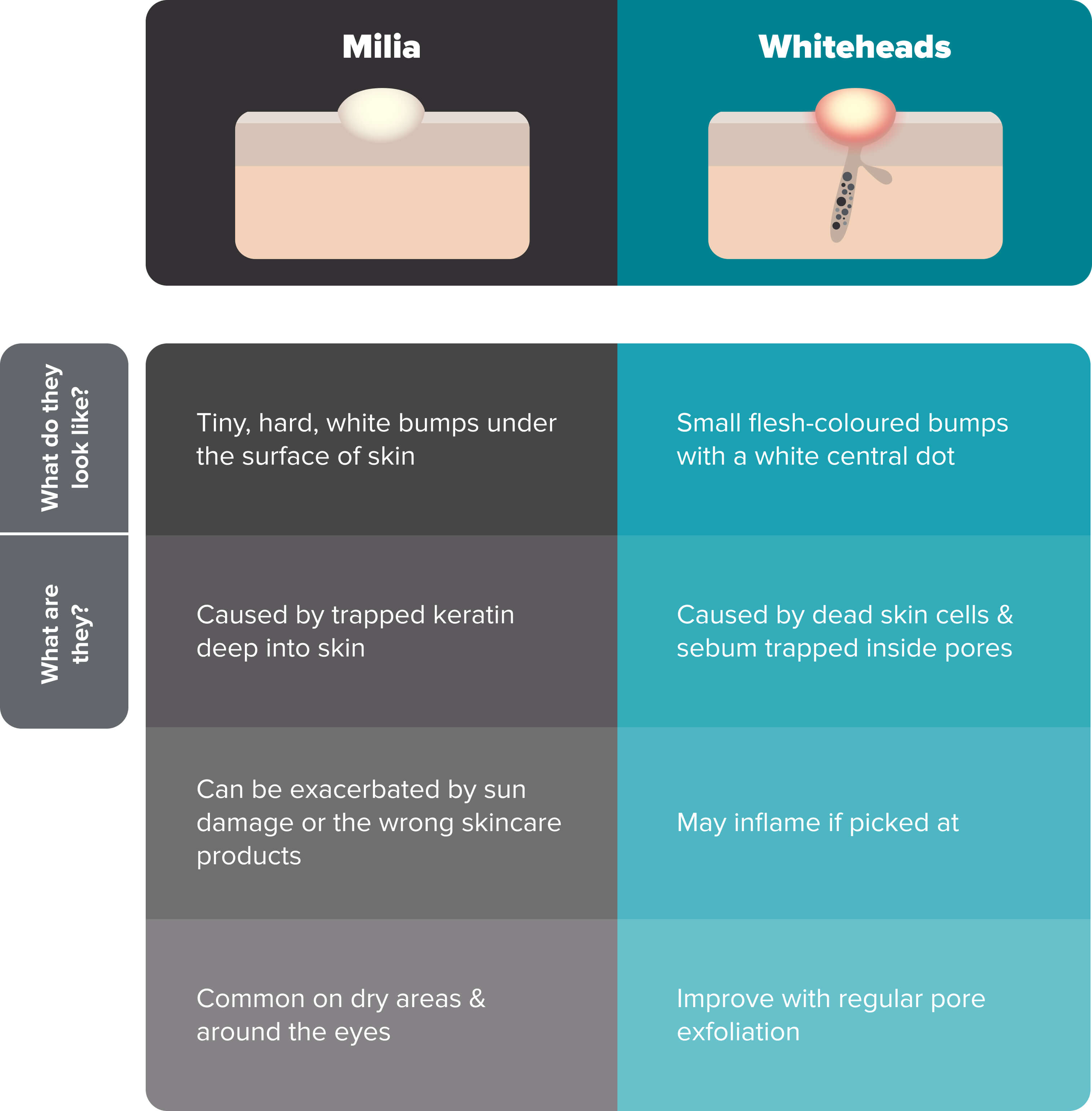 infographic-milia